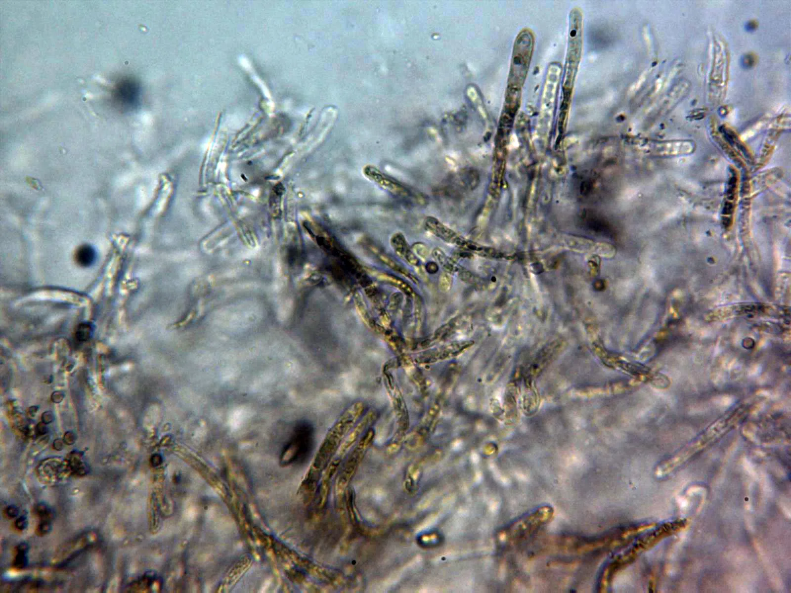 Microscopía de Rubroboletus lupinus - 11 - Cutícula pigmentada x 400